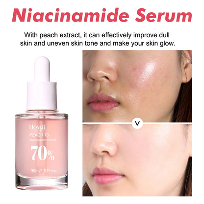 Hoygi Niacinamide Radiance Serum