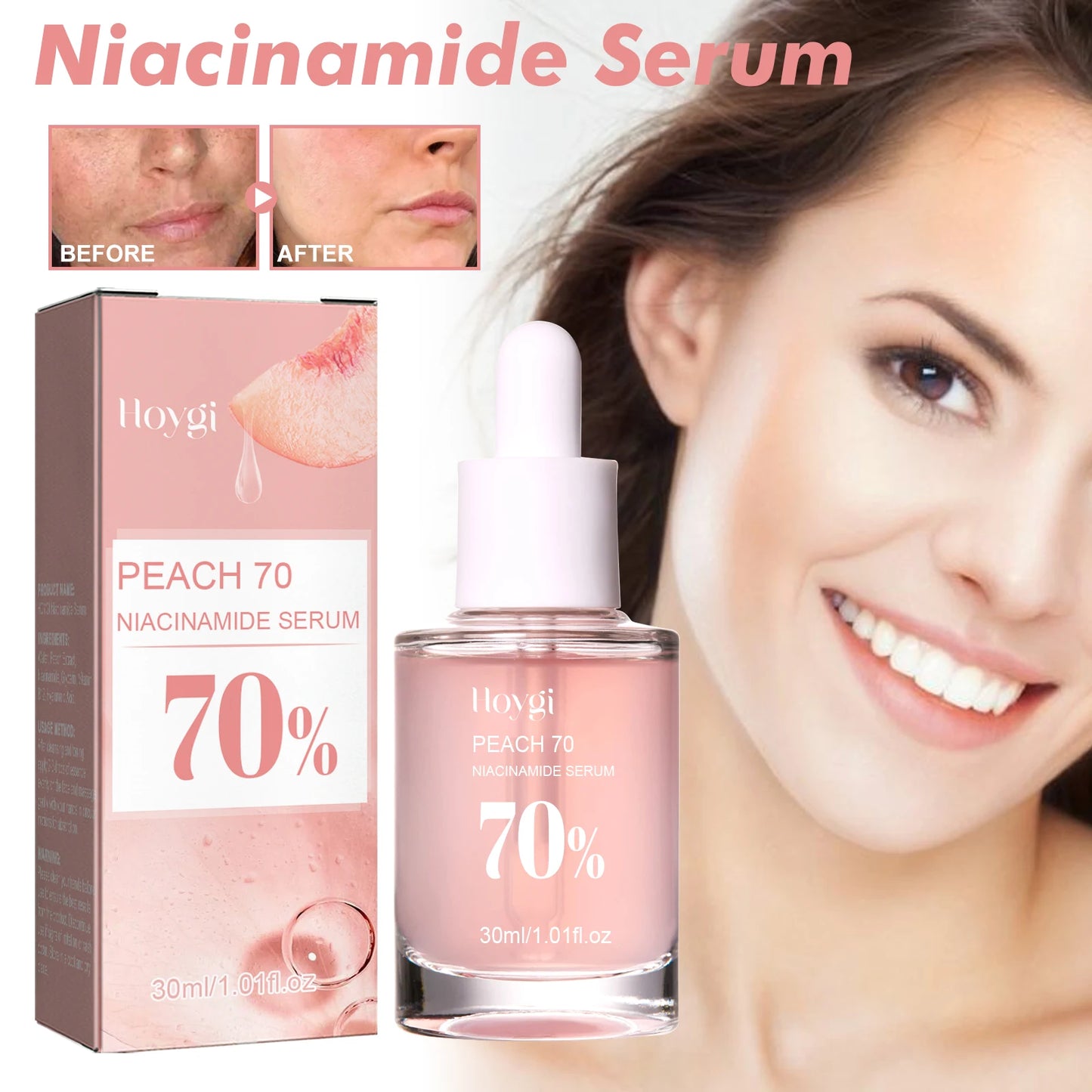 Hoygi Niacinamide Radiance Serum