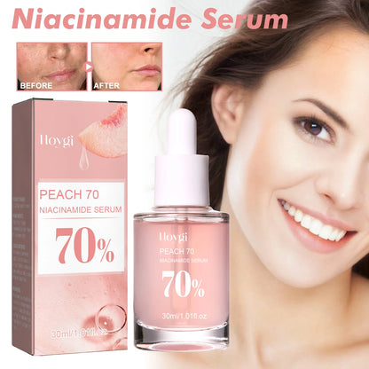 Hoygi Niacinamide Radiance Serum