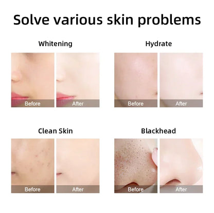 Missheart Hydra Aqua Facial Machine