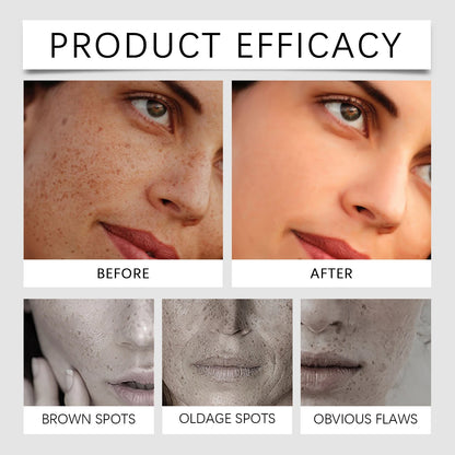 Advanced Dark Spot & Tone Correcting Cream