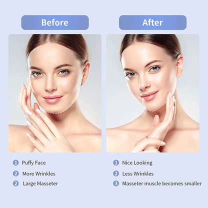 EMS V-Line Facial Lifting System